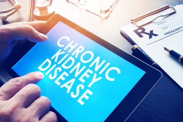 Early Signs of Chronic Kidney Disease: What to Watch For